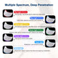 Foreverlily Electric Skin Rejuvenation Device – Anti-Wrinkle & Brightening Care