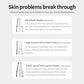 USB Rechargeable Electric Blackhead Remover Vacuum Face Pore Cleaner Whiteheads Black Spots Pimple Acne Extractor Skin Care Set