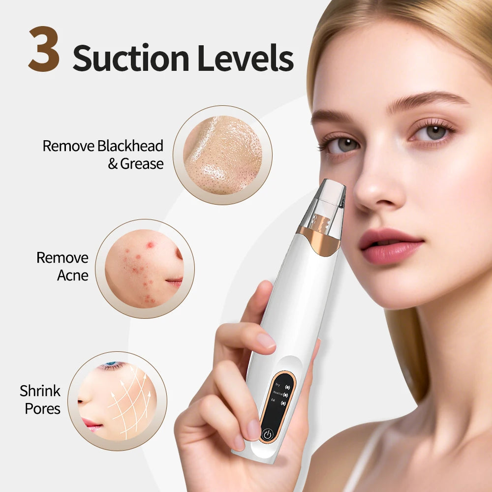 USB Rechargeable Electric Blackhead Remover Vacuum Face Pore Cleaner Whiteheads Black Spots Pimple Acne Extractor Skin Care Set